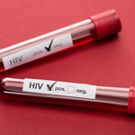 HIV. Wirus, którego można wyleczyć