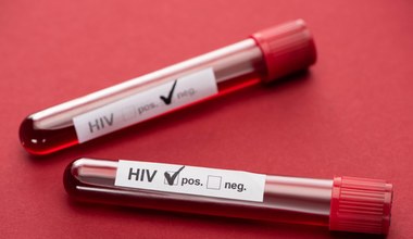 HIV. Wirus, którego można wyleczyć