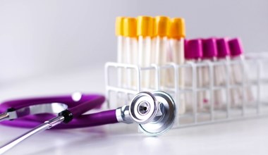 Hormon, który wiele powie o zdrowiu. Beta-hCG wykrywa nie tylko ciążę, ale też raka