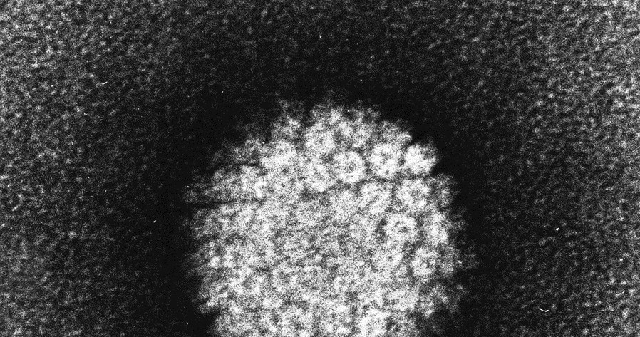 HPV w obrazie mikroskopu elektronowego (Fot. Laboratory of Tumor Virus Biology) /materiały prasowe