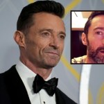 Hugh Jackman przez lata walczył z nawracającym rakiem skóry. Opowiada o objawach
