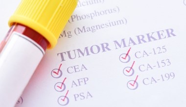 Ich obecność we krwi może sugerować raka. Czym są markery nowotworowe?