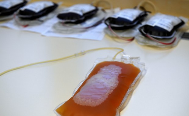 Idealny dawca osocza