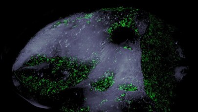 Ile bakterii zmieści się na ziarnku piasku?