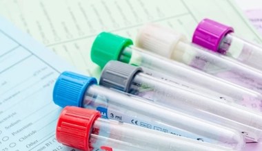 Ile mamy grup krwi? Jaka grupa jest najrzadsza? Zaskakujące odkrycia