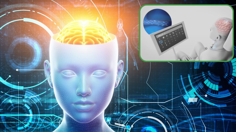 Implant mózgowy od firmy Synchron pozwala na wysyłanie wiadomości za pomocą myśli /123RF/PICSEL