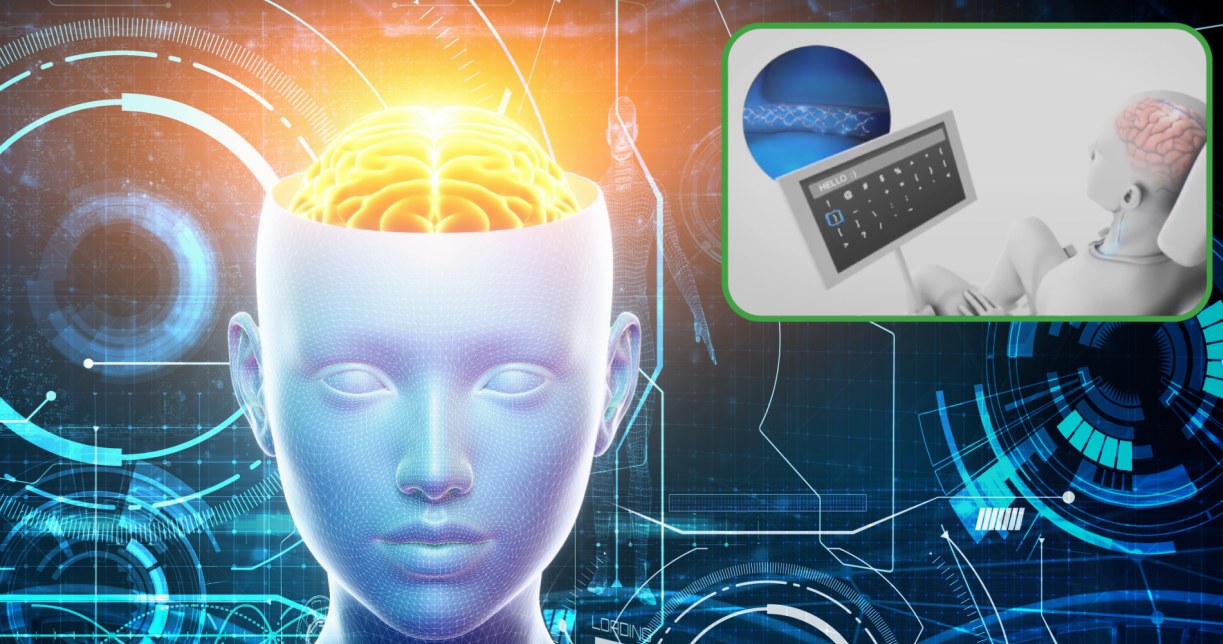 Implant mózgowy od firmy Synchron pozwala na wysyłanie wiadomości za pomocą myśli /123RF/PICSEL
