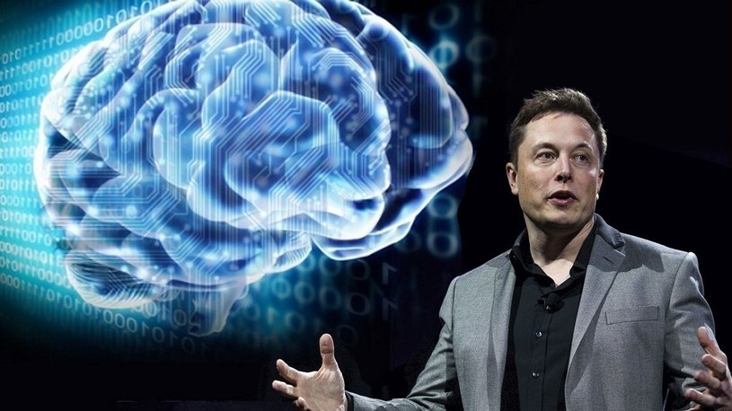 Implant od Elona Muska pozwoli na streaming muzyki bezpośrednio do mózgu /Geekweek