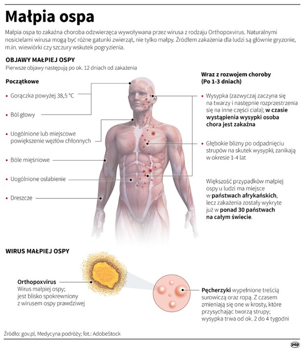 Informacje dot. małpiej ospy /Mateusz Krymski /PAP