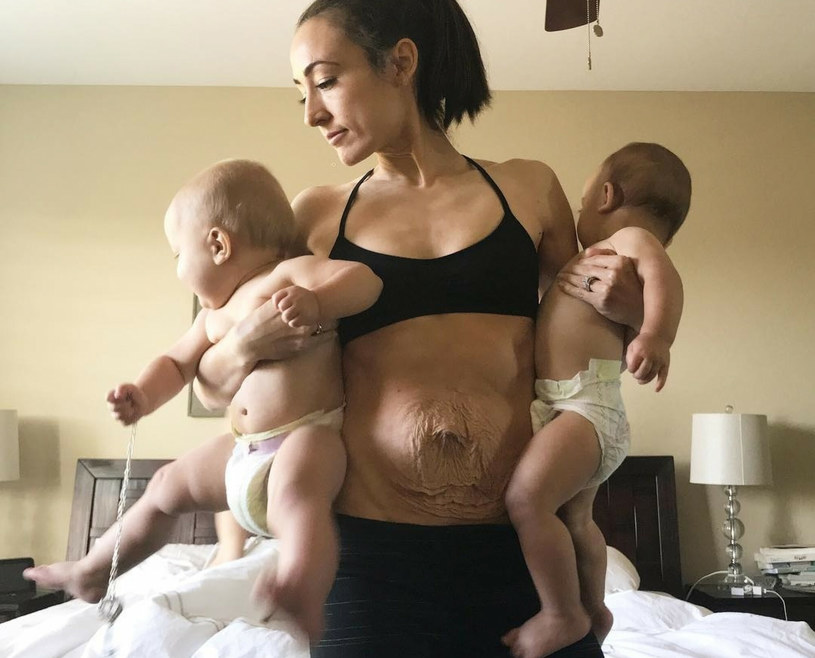 Instagramerka urodziła bliźniaki i po porodzie nie mogła wrócić do pełnej formy /mediadrumimages/@mrskyleeaustin/Media Drum/East News /East News