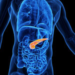 Insulinooporność: Przyczyny, objawy i leczenie dietą
