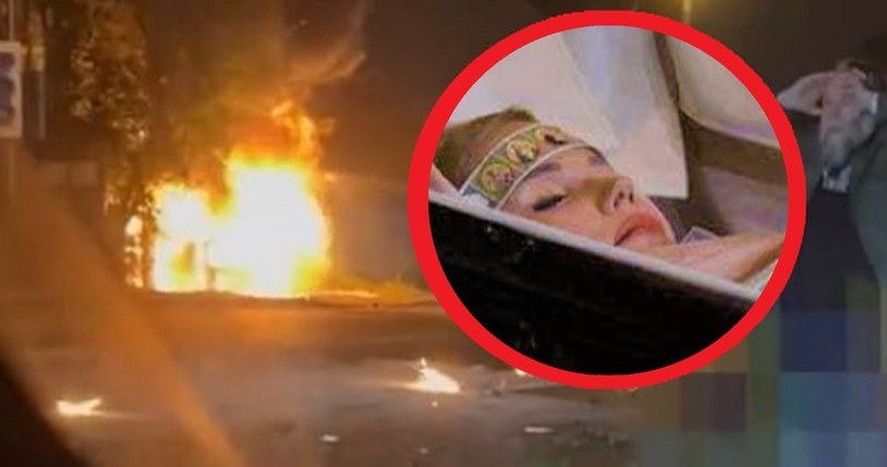 Internauci nie mogą uwierzyć, że tak wygląda twarz osoby, która doszczętnie spłonęła w samochodzie...