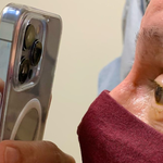 iPhone 13 - przy jego pomocy okulista leczy pacjentów