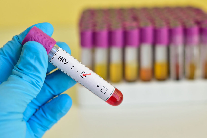Istnieje kilka rodzajów terapii antyretrowirusowych, które blokują HIV, a niekiedy pozwalają zmniejszyć jego obecność w organizmie do poziomów niewykrywalnych żadnym testem /123RF/PICSEL