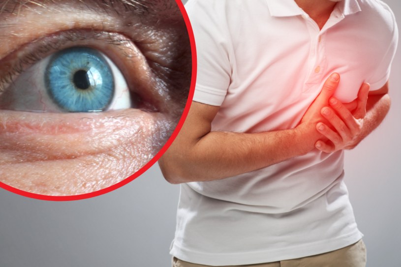 Badanie Naczyń Siatkówki Oka Tak Można Rozpoznać Ryzyko Zawału Serca Zdrowie W Interiapl 1525