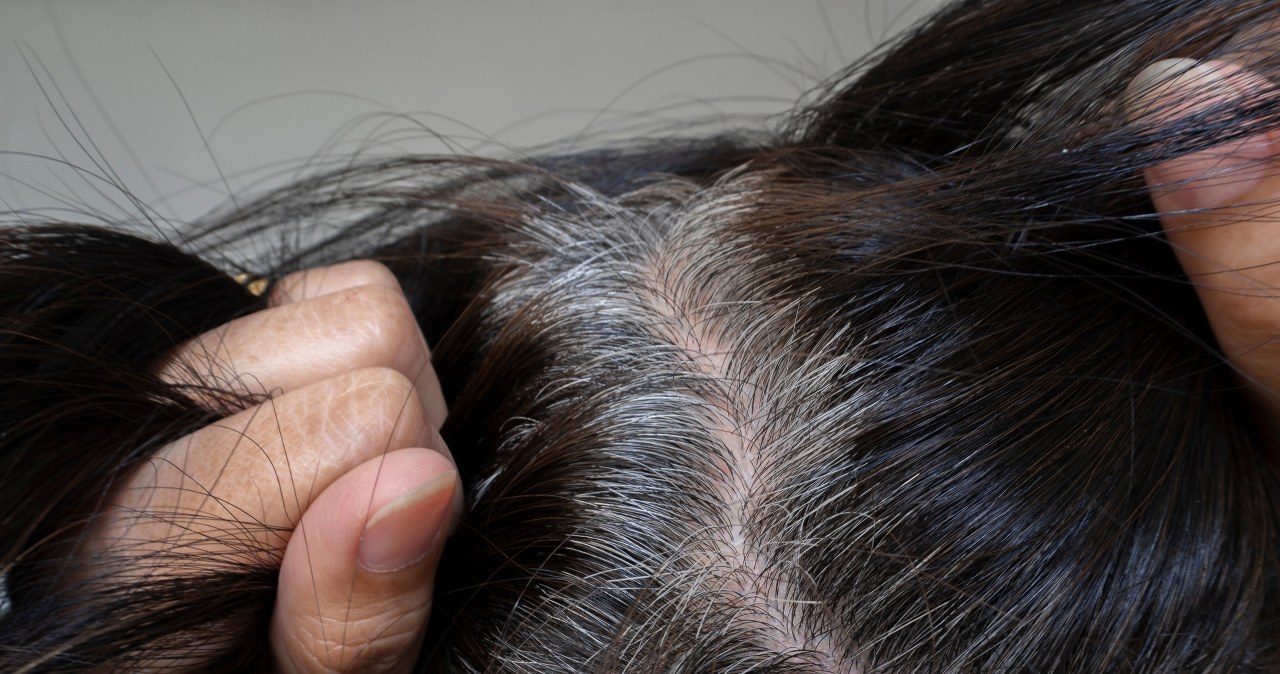 Ja poradzić sobie z siwym odrostem? Sięgnij po to popularne warzywo i przygotuj domową płukankę /123RF/PICSEL