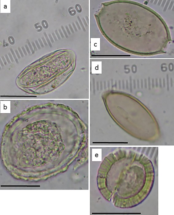 Jaja pasożytów wykryte w toalecie w Armon Hanatziv. (a). owsik ludzki ; (b). glista ludzka; (c). włosogłówka ( Trichuris suis); (d). włosogłówka (Trichuris trichiura); (e). tasiemiec nieuzbrojonysp. /Eitan Kremer /Materiały prasowe