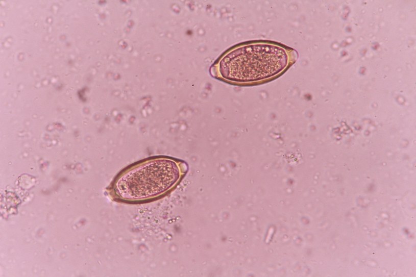 Jajeczka z larwami włosogłówki mogą znajdować się na produktach spożywczych /123RF/PICSEL