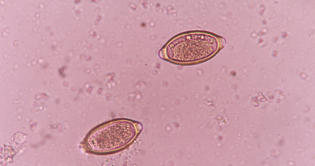 Jajeczka z larwami włosogłówki mogą znajdować się na produktach spożywczych /123RF/PICSEL