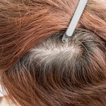 Jak cebula działa na siwe włosy? Użyj, a będziesz w szoku