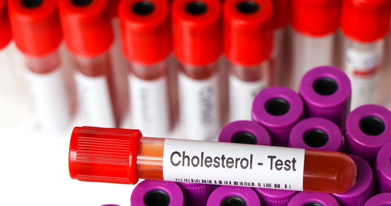 Jak często badać poziom cholesterolu? Częściej niż mogłoby się wydawać /123RF/PICSEL