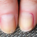 Jak dbać o łamliwe paznokcie?