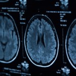 Jak fale mózgowe podczas snu pomagają usuwać toksyny z naszego mózgu