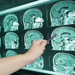 Jak koronawirus wpływa na starzenie się mózgu