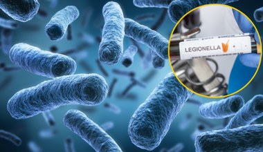Jak leczyć legionellę? Bakteria w Polsce i objawy choroby