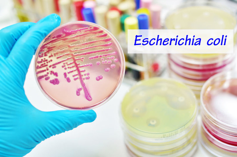 Jak może dojść do zakażenia bakterią E. coli? /&copy;123RF/PICSEL