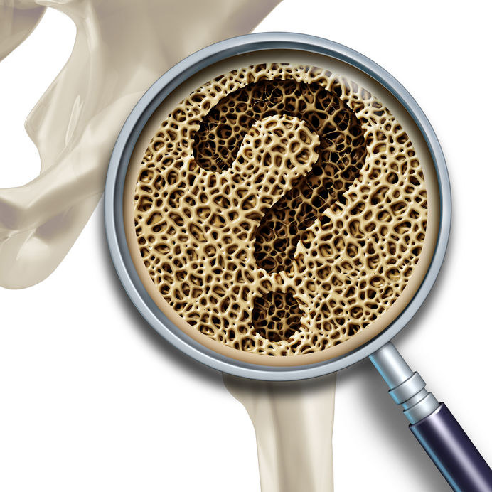 Jak objawia się osteoporoza? /&copy;123RF/PICSEL