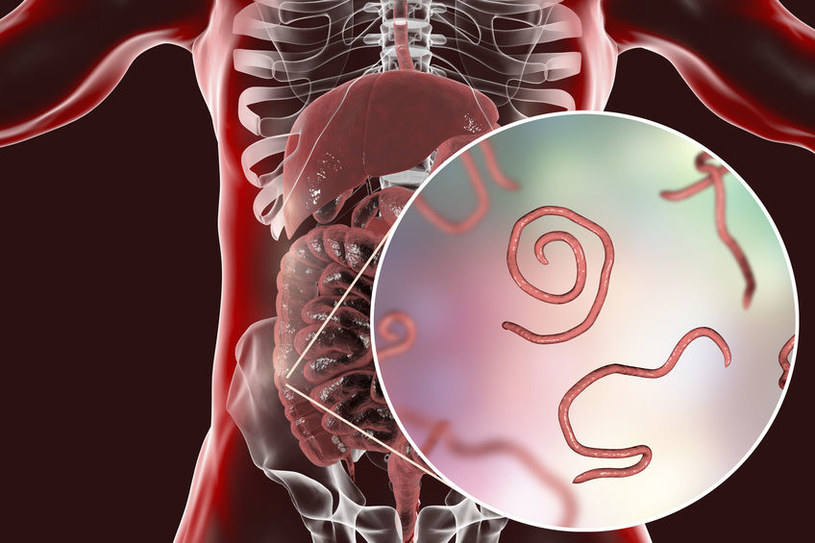 Jak Rozpoznać Obecność Pasożytów Porady W Interia Pl