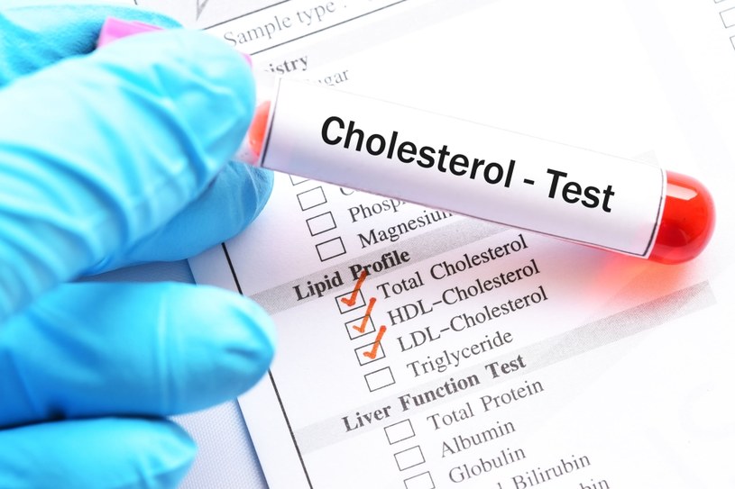 Jak odróżnić dobry cholesterol od złego? /123RF/PICSEL