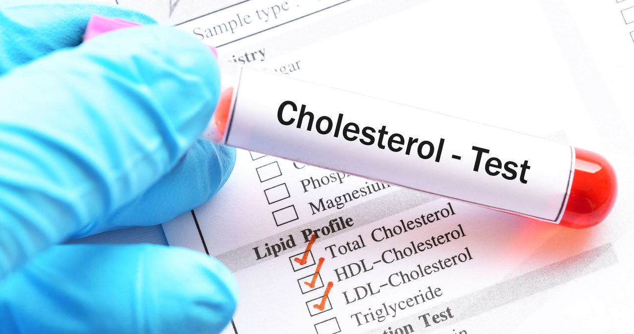 Jak odróżnić dobry cholesterol od złego? /123RF/PICSEL