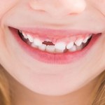 Jak pielęgnować zęby u dzieci?