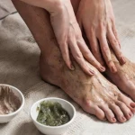 Jak pozbyć się suchych pięt bez tarki? Poznaj domowe maseczki, które działają cuda