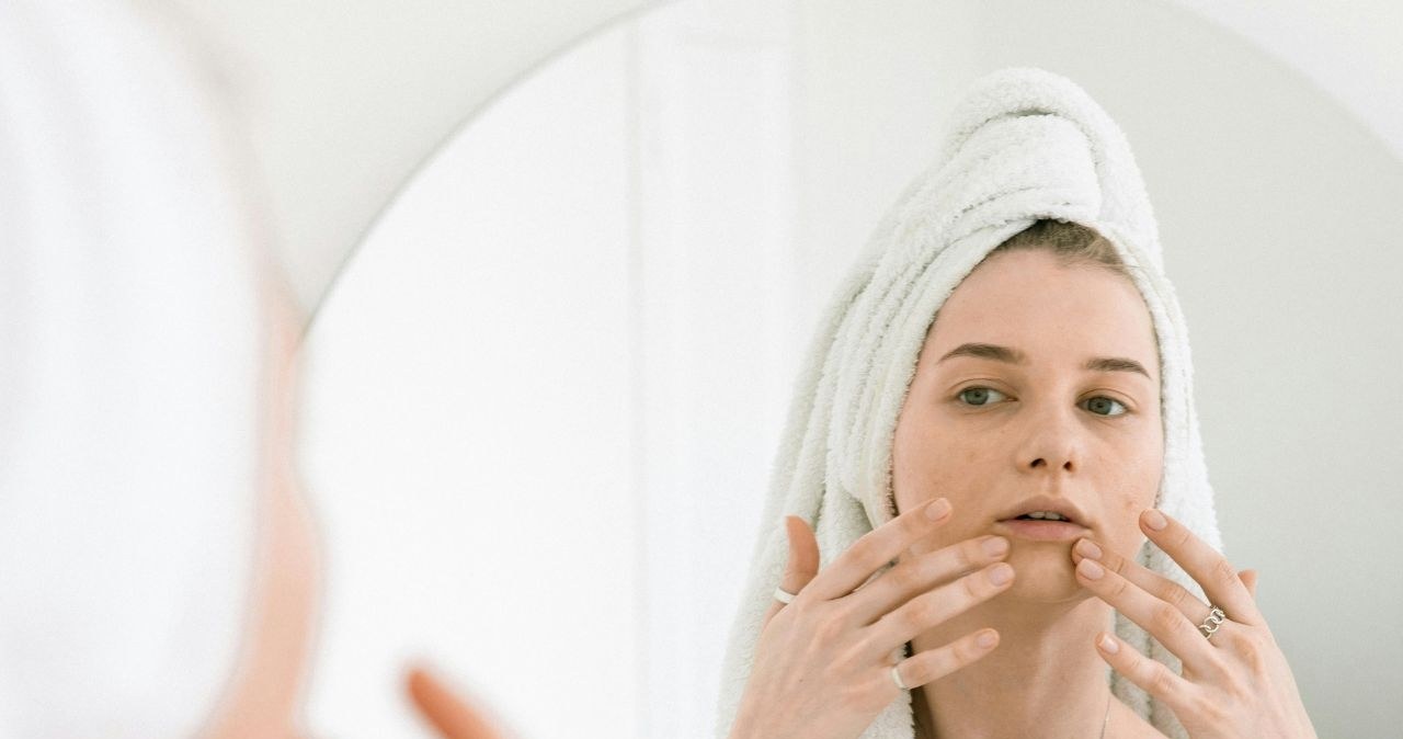 Jak pozbyć się wągrów i zaskórników domowym sposobem? /KATRIN BOLOVTSOVA /pexels.com