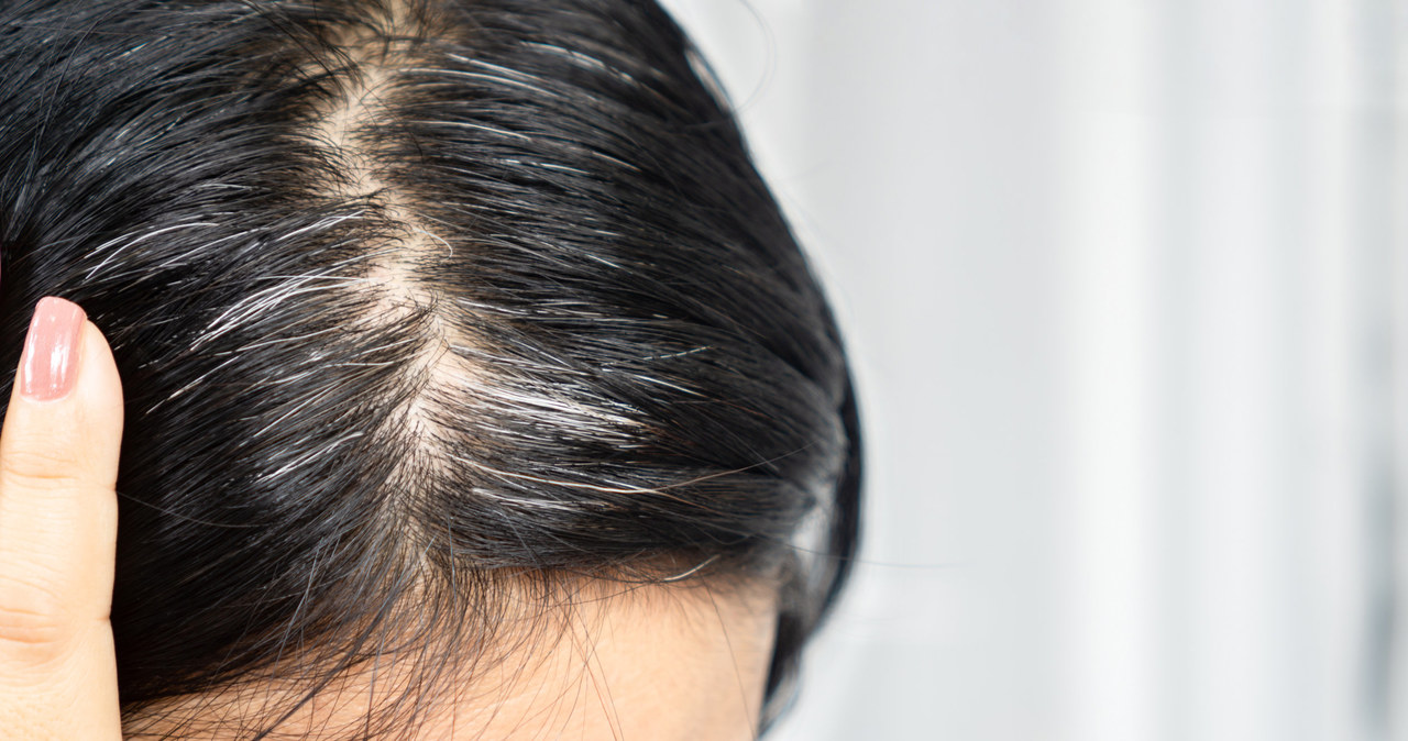 Jak przyciemnić siwe włosy? Te domowe sposoby nie zawodzą! /123RF/PICSEL