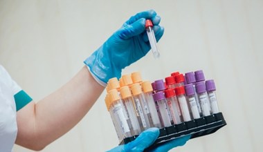 Jak rozszyfrować wyniki morfologii? Wyjaśniamy tajemnicze skróty w opisie badania