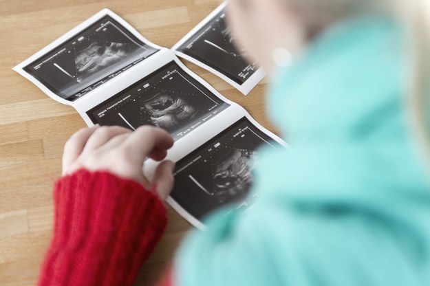 Jak twierdzą zwolennicy Ane-Vivo, podczas zapłodnienia wewnątrz organizm kobiety lepiej przystosowuje się do przyjęcia zarodka, a dzięki temu jest większa szansa, że zarodek się utrzyma i dojdzie do ciąży /KEYSTONE/Christian Beutler /PAP