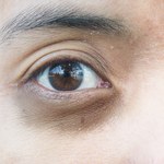 Jak usunąć cienie pod oczami? Skuteczne sposoby