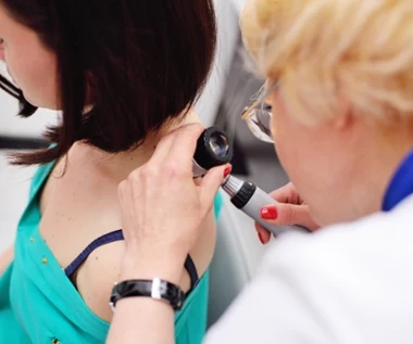 Jak wygląda czerniak? Jak diagnozuje się czerniaka? Ważne są też te badania