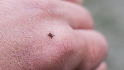 Jak wygrać z kleszczem i uniknąć problemów