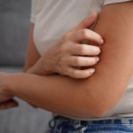 Jak wykrywa się boreliozę? Tak wygląda pierwszy, a tak drugi etap diagnostyki