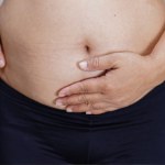 Jak zadbać o bliznę po cesarce? Zabiegi stosuj w odpowiednim momencie