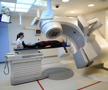 Jak zapobiegać skutkom ubocznym radioterapii?
