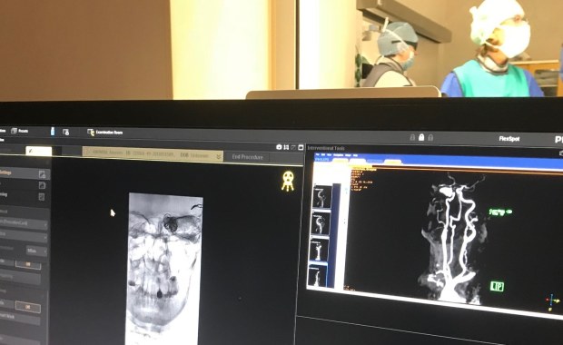 Jak zobaczyć tętnice i żyły na żywo? Nowoczesny angiograf otwarty w Olsztynie