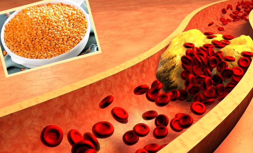 Jak zwalczać cholesterol? Podstawą jest zdrowa dieta obfitująca w produkty takie jak: czerwona soczewica /Pixel