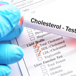 Jaki cholesterol jest dobry?