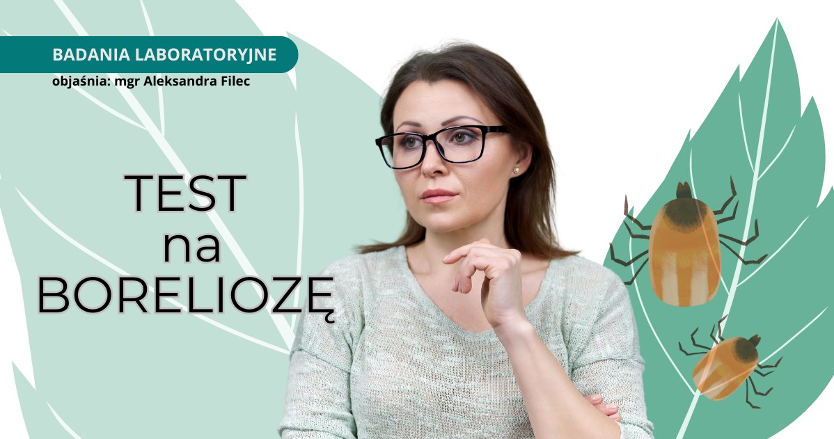 Jakie badania pozwalają wykryć boreliozę? Czym się różni test ELISA od testu Western blot? Wyjaśniamy /123RF/PICSEL